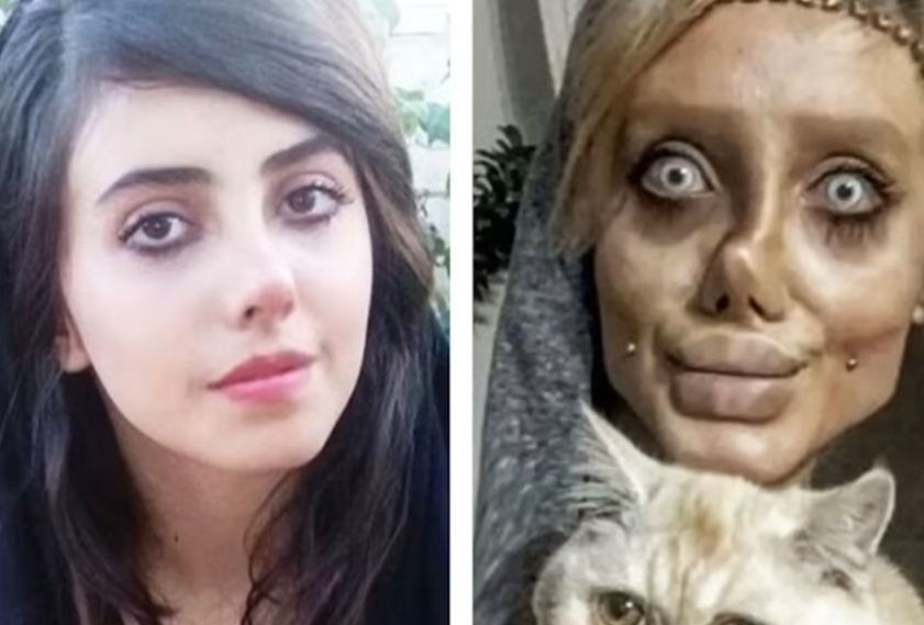 10 Most Extreme Celebrity Plastic Surgery Disasters: Facial Fusion ...